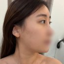 뷰티온피부과의원 양주옥정점 | 옥정 피부관리&amp;헤드스파 뷰티온 윤곽관리 후기