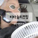 명동건강사우나 | 명동 회현역피부과 티타늄리프팅 변화 후기