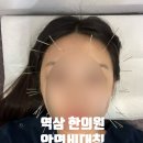 남서울한의원 | [서울 강남] 퇴근 후 야간진료 가능한 역삼 한의원 안면비대칭 안면윤곽 교정 후기