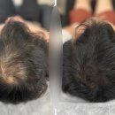 블랭크smp 이미지