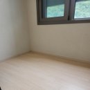 뷰 클리닝 이미지