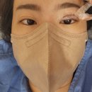 양재욱 | 갑상선 항진증+ 안병증 투병일기 4