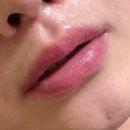 마천로2 | 망한 입술문신제거 2차 반영구 송파잔흔제거 예쁘닷 노레이앰플 후기