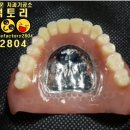 스마일기공소 이미지