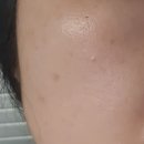 퍼스트메드 | 스킨메드 큐템 세라밤 퍼스트 미백 세라마이드폭탄 앰플