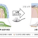 뇌막에 쌓인 당 뇌 기능 장애 부른다 이미지