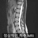 리즈핏 PT 이미지