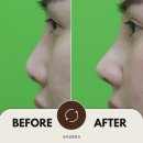 로이성형외과의원 이미지