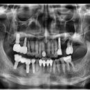 서울오브치과병원 이미지