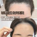 라인아카데미 | 대구반영구 헤어라인 뷰티콩드아카데미 일대일 맞춤후기