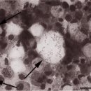 벤자리(Parapristipoma trilineatum)의 Francisella philomiraqia 이미지