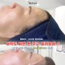 인계동 952-5 | 반신반의했던 헤어라인왁싱 수원 영통왁싱샵에서 한 번 받아봤는데요