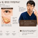 카성형외과 | [에프아이성형외과] 40대 눈밑지방재배치 후기, 원인부터 알아야 결과가 다릅니다