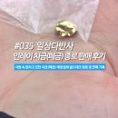 강성도 | [일상] 인레이 치금(폐금) 종로 판매 후기 (금니 판매, 금니 시세)