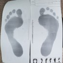 뉴서울사 | 발건강전문회사 오소틱연구업체 이젠피트 발석고본뜨기