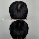 프로스칼프부산 이미지
