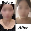 세븐일레븐광주수완삼광점 | 광주 수완지구ㅣ윤곽관리 에스테틱ㅣ약손명가 K-뷰티 후기ㅣ연예인 관리 솔직 리뷰
