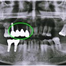 이수치과기공소 이미지