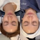 시그니처약국 | ［ 광진 / 자양 ] 구의역피부관리 스킨스튜디오 프리미엄 시그니처 케어 후기｜건대피부관리 추천