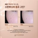 로아르피부과의원 이미지