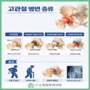 덕소성외과의원 | 있습니다. 고관절 병변의 치료와 수술 후 재활까지 정리 [대구 수성구 지산동·범물동 큰숲정형외과의원]