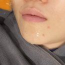 트리메드 이미지