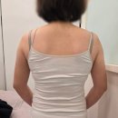 365MC의원 | 원 미만 결혼하기] 예비신부 관리 팔뚝 무한람스 내돈내산 후기(당일, 1~4주일 상세후기) / 365mc 신촌점