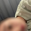 미올한방병원 | 임신 15주 임산부 접촉사고 : 산부인과 및 한방병원 진료 후기