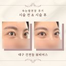 루루앤아이래쉬 | 대구 진천동 대천동 속눈썹연장 루루앤아이래쉬, 뷰티어스