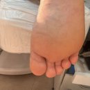 레푸스 화정점 이미지