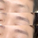 아인뷰티의원