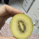 강서미즈메디 병원 자궁근종 로봇 수술 후기_(3) - 퇴원 이후 한 달 차, 비잔정 치료 및 부작용