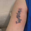 1회 사진기록전 | 문신제거 1회차 타투제거 전후 강남 리스킨타투 후기