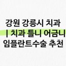 강릉조은이플란트치과 네이버블로그