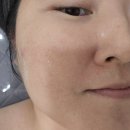 네오블랑 | 군산 피부관리 지움뷰티 네오블랑 솔직후기