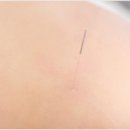 서현 황제한의원 이미지