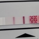 연세가산산부인과의원 | 연세가산산부인과 임신 수치 더블링 / 임테기 역전 / 임신확인증 발급