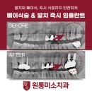 원통미소치과의원 티스토리