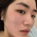 다이어트핏 | [경북/포항] 셀포랩 리즈핏 다이어트 프로그램 체험 후기/ 포항 다이어트/ 포항체형관리