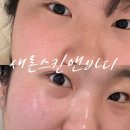 새론스킨앤바디