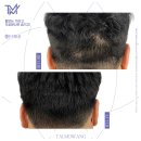 탈모왕 본점 이미지