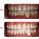 엘리트덴탈 이미지