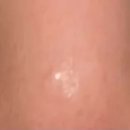 스누피부과의원 이미지