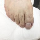 오른발왼발중앙점 | 동탄 발관리, 문제성발관리 전문샵 솔직후기 레푸스동탄반송점