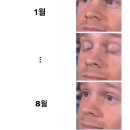 8에이커 이미지