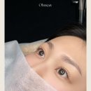오눈 | 성남 오눈, 속눈썹 펌 시술사례 (성남 속눈썹펌)