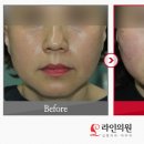 티나성형외과의원 이미지