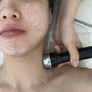 O2헤어 | 천안문제성피부관리 더레이디뷰티 연예인재생관리 후기 (장벽강화 관리)