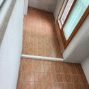 뷰 클리닝 이미지