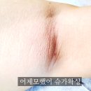 어제모했어슈가왁싱